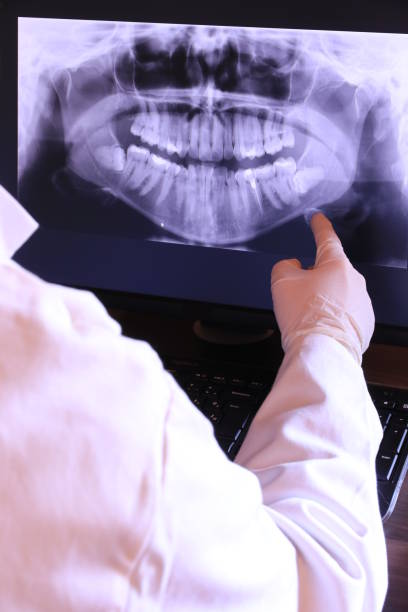 Best Emergency Dental Surgery in Keasbey, NJ