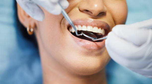 Best Emergency Tooth Extraction in Keasbey, NJ